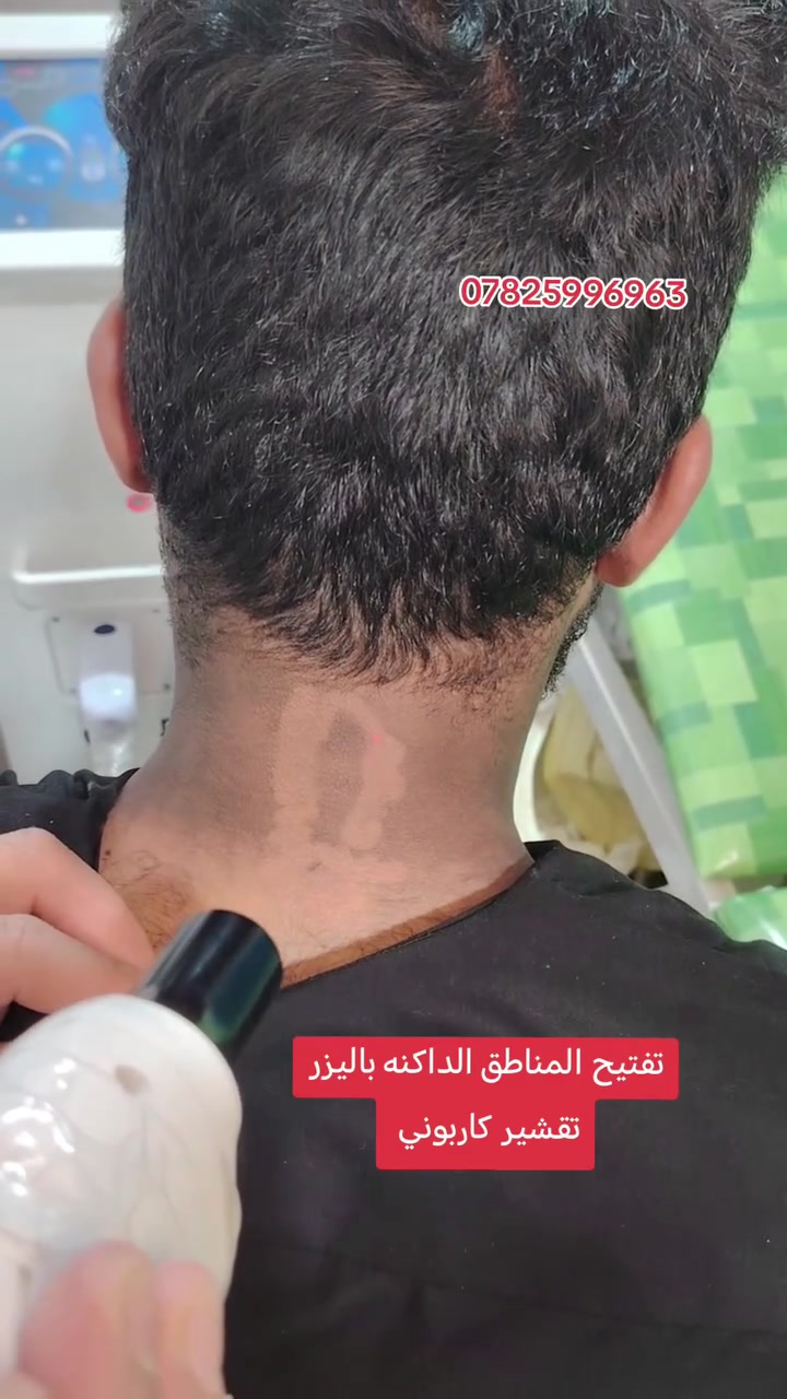مركز وحلااقه الشيخ 
العنوان الناصريه الاصلااح مقابيل فلكه
*********** @إشارة
