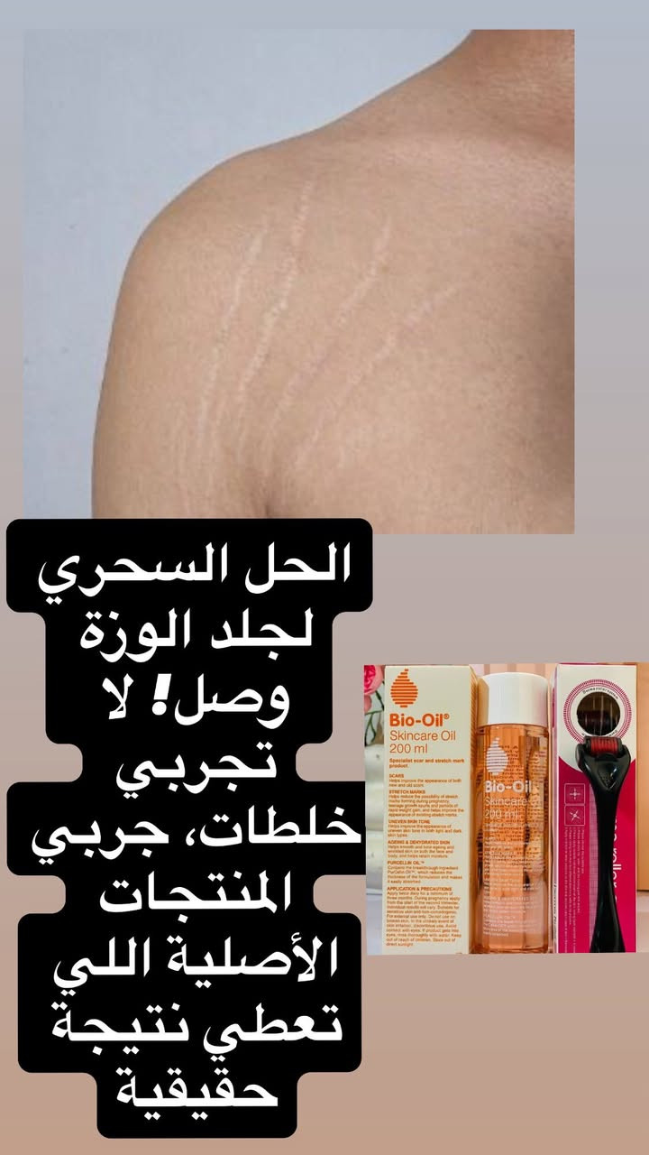 دائما عروض العيد غير
سارعو بالحجز وباسعار تنافسيه تموت


**إذا كنت صاحب هذا الإعلان وتريد حذفه لأي سبب، رجاءا أرسل رسالة إلى الدعم الفني**