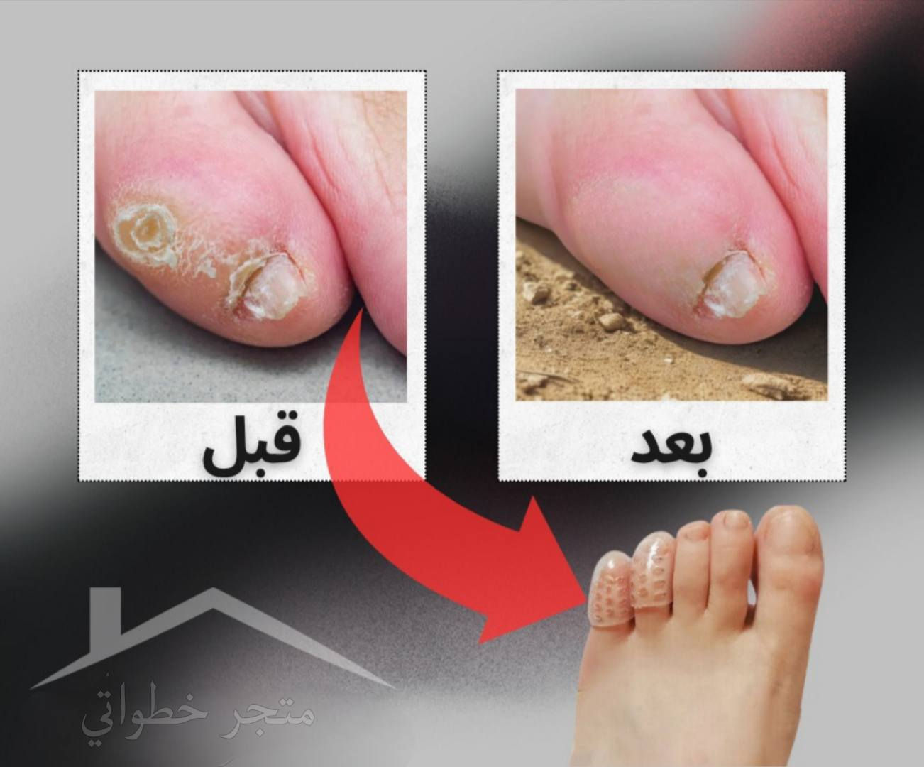 وداعاً لألم الأصابع والفركاسات! 🦶✨

#متجر_خطواتي جابلك الحل السحري والأكثر طلباً:

✅ واقي الأصابع السيليكوني الطبي:

مرونة عالية جداً وتناسب كل أحجام الأصابع.
يحتوي على فتحات تهوية حتى رجليج تبقى مرتاحة وما تعرق.
يحمي أصابعج من الاحتكاك المباشر بالحذاء، يعني تمشين براحتج طول اليوم.

💰 السعر صدمة: 3 آلاف دينار فقط!
📦 الباكيت يحتوي: 10 قطع (يعني يكفيج ويوفي لكل أحذيتج).

العنوان بابل قضاء المسيب متوفر توصيل لجميع محافظات العراق 5الاف 

#متجر_خطواتي #راحة_القدم #سيليكون_طبي #حلول_ذكية #تسوق_نسائي #العراق


**إذا كنت صاحب هذا الإعلان وتريد حذفه لأي سبب، رجاءا أرسل رسالة إلى الدعم الفني**