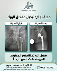 الدكتور احمد محمد حسين  بورد في جراحة العظام والمفاصل والكسور  للاستفس...
