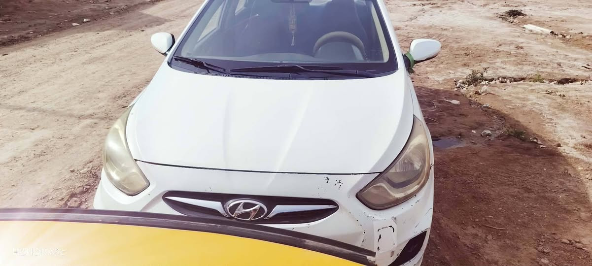 اكسنت 2015خليجي مكينه كير كفاله وشرط تخم تاير جديد حداديه جديده بيه طخات بسيطه تجي وتشوف بعينك وتكلب وتقتنع
اني مكلف بنشر رقم صاحب السياره *********** السعر 72وبيه مجال للطيبين
