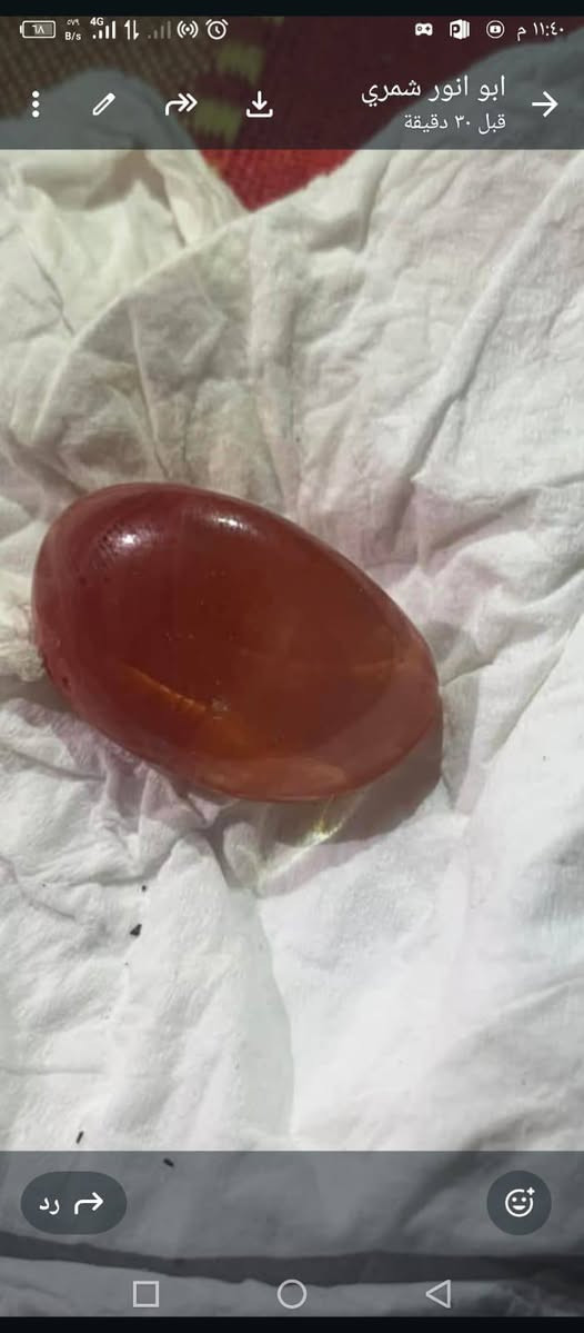 عقيق يماني  طبيعي خامه قديمه طبيعي على فحص شراي ادخل خاص


**إذا كنت صاحب هذا الإعلان وتريد حذفه لأي سبب، رجاءا أرسل رسالة إلى الدعم الفني**