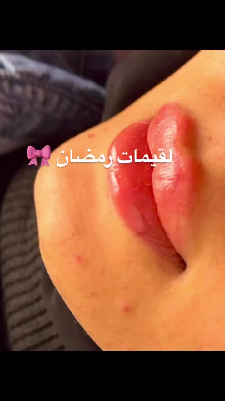 #لقيمات رمضانية 🎀🙃


**إذا كنت صاحب هذا الإعلان وتريد حذفه لأي سبب، رجاءا أرسل رسالة إلى الدعم الفني**