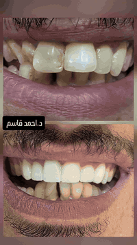 حياة جديدة 😍 😍 
ابتسامة جديدة 😁 😁 

ننوه لكم يوجد نظام اقساط عل منصة اقساطي مصرف الرافدين 
ولمدة عشرة اشهر 
العنوان ✨️ ✨️ 
بابل المدحتية مقابل مجمع زيد وايهم 
للحجز والاستفسار 
***********
