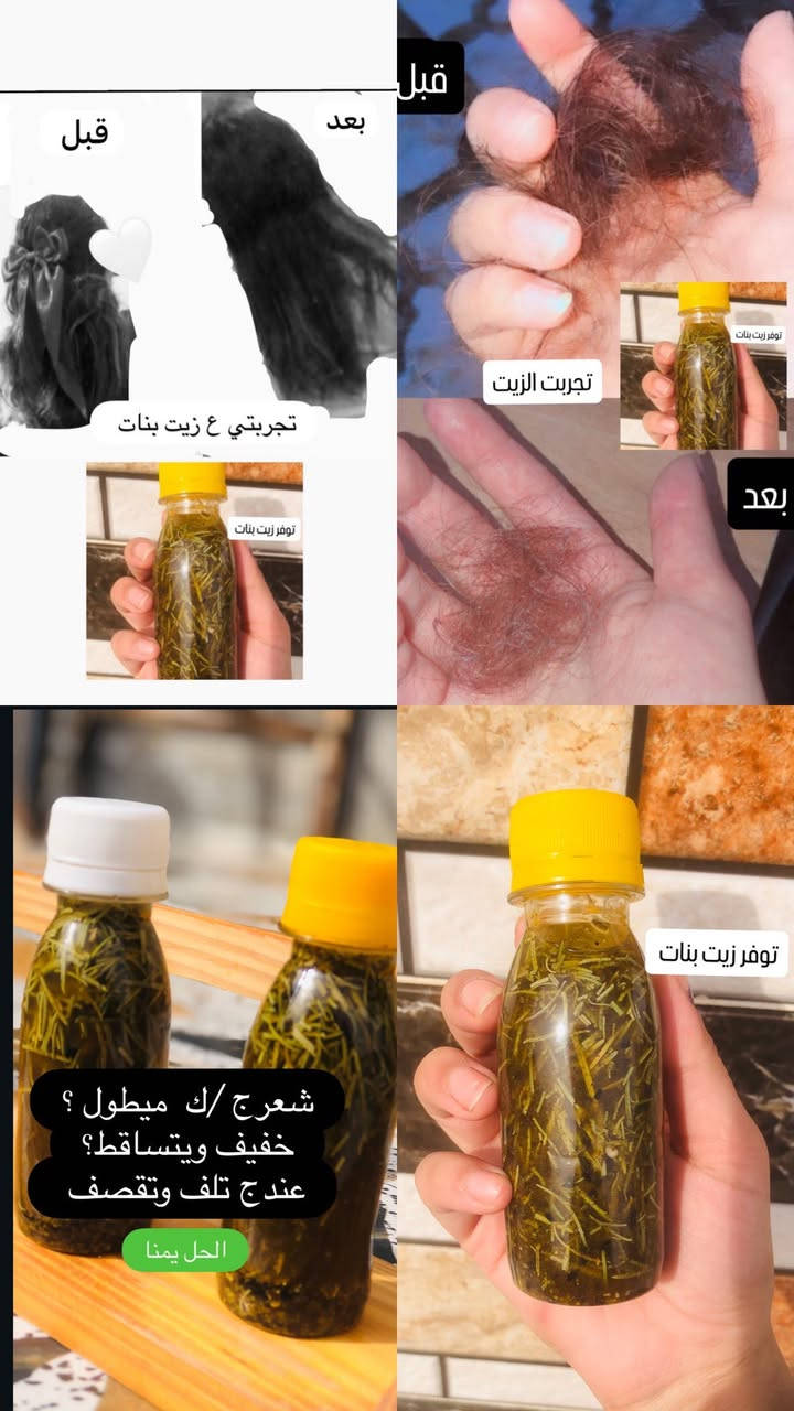 سلام عليكم بنات وشباب  متوفر زيت شعر مجرب ومضمون نتيجه كدامكم تحجي وسعر كلش مناسب ومتوفر توصيل جميع محافضات 🤍


**إذا كنت صاحب هذا الإعلان وتريد حذفه لأي سبب، رجاءا أرسل رسالة إلى الدعم الفني**