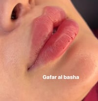 عروض العيد • بوتكس • ميسان مغربه