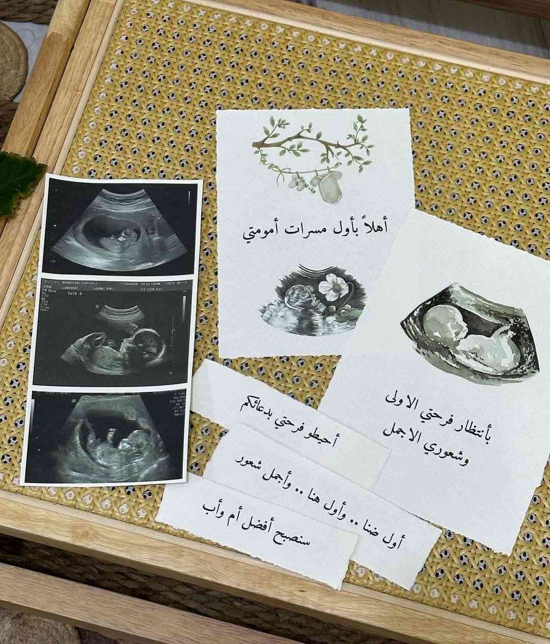استيكرات لتصوير جلسه حمل وبيبي حسب طلب
للحجز والأستفسار مراسلة الخاص او الواتس اب
***********
توصيل جميع محافظات العراق
#اكسبلور #اللهم_صلي_على_نبينا_محمد #تصوير_جلسة_حمل #تصاميم_دودو_اليدوية #dudu_works

