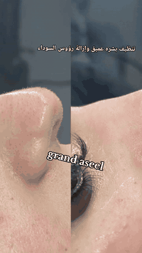 العنوان _بغداد _الدوره_ شارع الصحه _مقابيل حلويات ابن نايف _عماره ركن الملك _الطابق الثاني _شقه رقم 5📍
للحجز والاستفسار _ ***********📞
💎 جمالك هو مهمتنا #كَراند_اسيل
