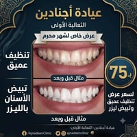تلميع وتبيض الاسنان فقط ب 75 للاستفسار اكثر 07718984882