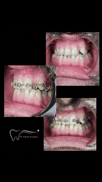 Dr : Wasan 

عيادة الدكتورة وسن الجبوري / لطب وتجميل الاسنان /ديالى  بعقوبة / شارع البحيرة 

للحجز والاستفسار مراسلة الصفحات الرسمية للعيادة على الفيس بوك و انستكرام 

او الاتصال على الرقم التالي (***********)
