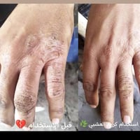 كريم اليكس • صابونة الصنوبر • منتجات ايرانية