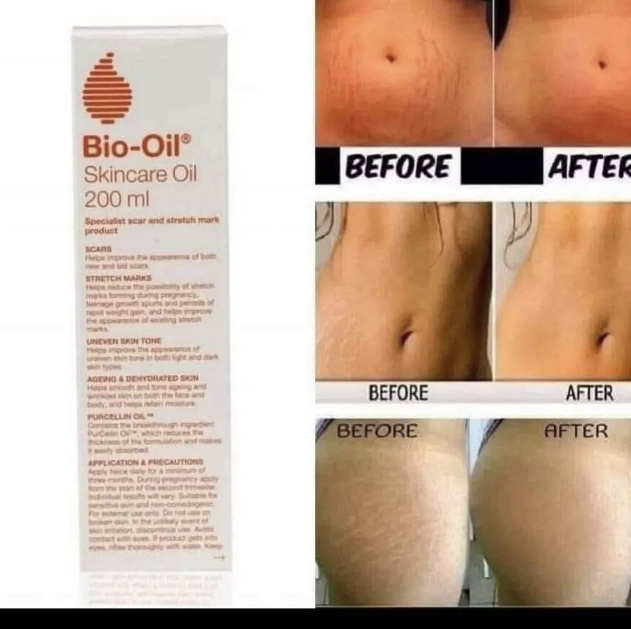 ✨ لأن بشرتج تستحق عناية حقيقية ✨

زيت Bio-Oil الطبيعي من المنتجات اللي كثير ناس حبّته بسبب خفته ونتيجته الحلوة مع الاستخدام المستمر 🤍
قوامه خفيف جدًا عالبشرة وسريع الامتصاص، يعني ما يترك إحساس مزعج أو دهني بعد الاستخدام.

يساعد على تحسين مظهر علامات التمدد والندبات، ويعطي ترطيب ونعومة واضحة للبشرة، خصوصًا بالمناطق الجافة أو اللي تحتاج اهتمام أكثر 🌿

حلو للاستخدام اليومي وبعد الشاور، ويخلي البشرة أنعم وأنضر مع الوقت ✨

▫️ تركيبة طبيعية 100%
▫️ مناسب للعناية اليومية
▫️ ترطيب بملمس خفيف
▫️ حجم 125ml
:::


**إذا كنت صاحب هذا الإعلان وتريد حذفه لأي سبب، رجاءا أرسل رسالة إلى الدعم الفني**