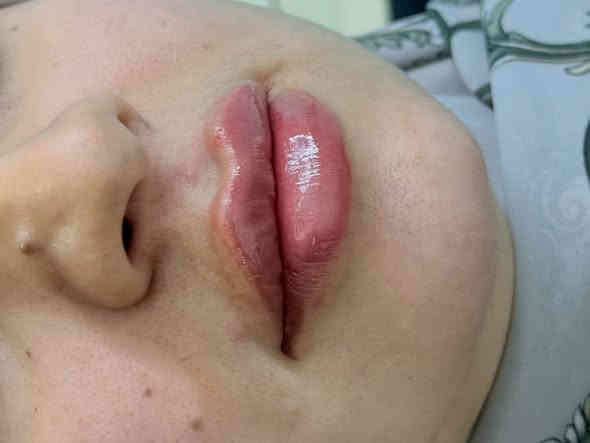 المسيب *********** الدكتوره فيد موفق ❤️‍🔥   

#فلر #فلرشفة_فلر_وجنات_فلرخطوط_ضاحكة_فلرذقن_تكساس_تكنيك❤️❤️❤️ #الشعب_الصيني_ماله_حل😂😂
