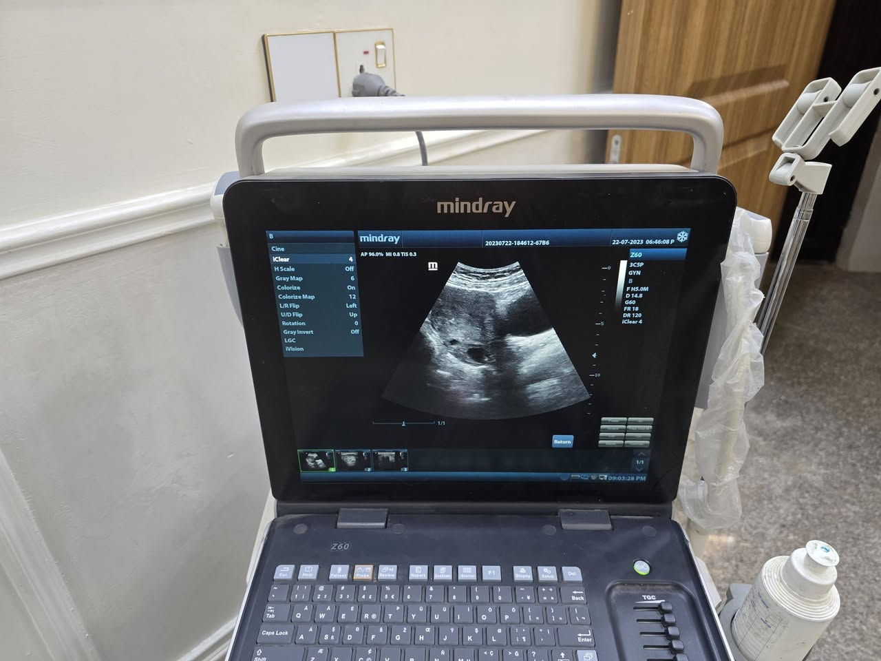 السلام عليكم جهاز سونار بحالة جيدة جدا التفاصيل في الصور . بيع مستعجل  
للاستفسار عن السعر الاتصال بالرقم
*********** و واتس اب متوفر
