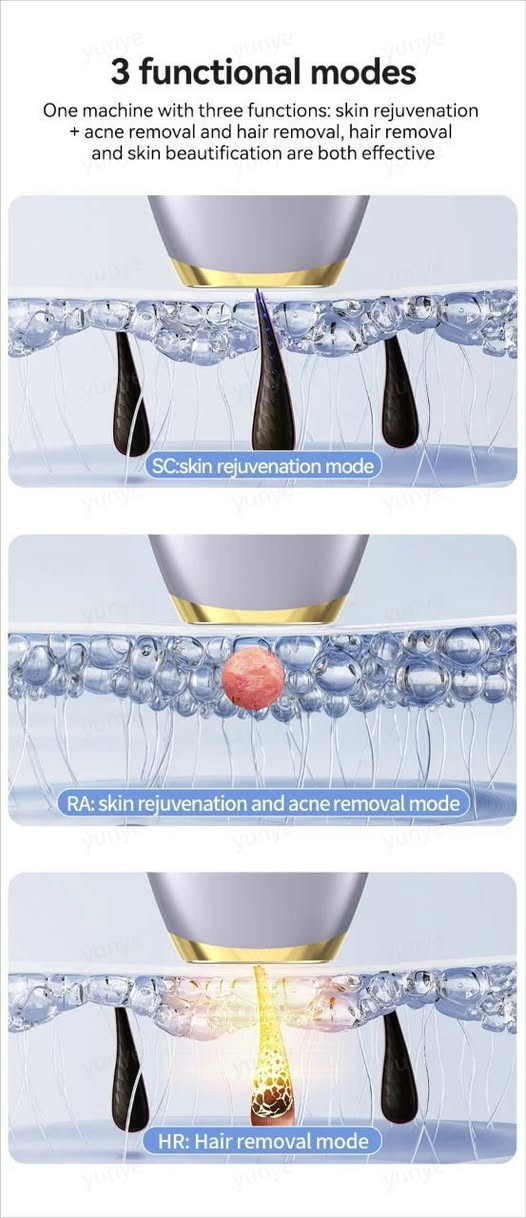 لێزەری  کۆمپانیای Jindi

بێزار نەبوی لەوەی هەموو ڕۆژێک گوێزان 
بەکار بهێنی کە دەبێتە هۆی ڕەش بوون و تۆخ بونی هەموو پێستت و هەستیاری و زیپکە وەرە من باشترین لێزەرم بۆ هێناوی کە تەنها چارەسەرە بۆ نەمانی موو بۆ هەمیشە جا لەگەڵم وەرە با سودەکانی ئەم لێزەرە ناوازەیەت پێ بلێم:

١-کۆتای هێنان بەموی تەواوی جسم و ڕوخسار✅

٢-بۆ هەر جێیەک بەکاری بهێنی سپیدەکاتەوە ✅

٣-نابێتە هۆی زیپکە و هەستیاری✅

٤-تیشکی ساردە و ئەزیەتی پێستەکە نادا✅

٥-بەهەمان شێوەی لێزەرەی سەنتەرەکان بەهێزە✅

٦- جیاواز لە لێزەرەکانی دیکە ٩ دەرەجەی قوەتی هەیە ✅

٧-کار لە توندکردنەوەی پێست دەکا✅
٨- تیشکی بێ کۆتایە.
٩- شاشەکەی لەمسە.
١٠- بە ٤ مانگ موو بنەبڕەکات ئەمە لەکاتێکدا لێزەرەکانیتر ئەبێ ٦ مانگ بەکاری بێنی بەلای کەمەوە ئینجا موو بنەبڕ ئەکات.
١١- زەمانی یەک ساڵی لەگەڵە.
١٢- بە زەمان موو بنەبڕ ئەکات.
١٣- ڕاستەوخۆ بە کارەبا کارەکات.

ئەگەر بە دوای لێزەرێکی باشدا دەگەڕێت کە لەماڵەوە موەکانت نەهێڵێ لەم لێزەرە باشترت دەس ناکەوێ زەمانی یەک ساڵی لەگەڵدایە دوو دەم و عەینەک و گوێزانی تایبەتی لەگەڵدایە جگە لەوەش بەبێ دیاری نابێ جێڵێکی ئالۆڤێرا و بەنجێکی زۆر باشی لەگەڵدا هەدیەی ئێمەیە 💝
لەوە باشتر چی پەلە بکەن لە داواکردنی ئەم لێزەرە ناوازەیە کە مونافسی لێزەرەی سەنتەرەکان دەکا و لەگەڵ ئەوەشدا نرخەکەی زۆر گونجاوە و خۆت ڕزگار بکە لە موە نەخوازراوەکانی جەستەت 

کۆمپانیای Jindi
ئەم کۆمپانیایە سەپۆرتی بەرهەمهێنانی لێزەرەکانی LESCOLTEN و MLAY و ICON و FLOWA ئەکات، ٦ بڕوانامەی نێودەوڵەتی هەیە و گرنگترین بڕوانامەی  هی ئایزۆی نێودەوڵەتیە.


**إذا كنت صاحب هذا الإعلان وتريد حذفه لأي سبب، رجاءا أرسل رسالة إلى الدعم الفني**
