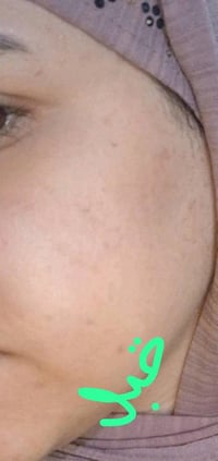 شنو هيه الخلطه الملكيه؟؟   هيه مجموعه من منتجات فوريفر جمعناهه الكم بع...