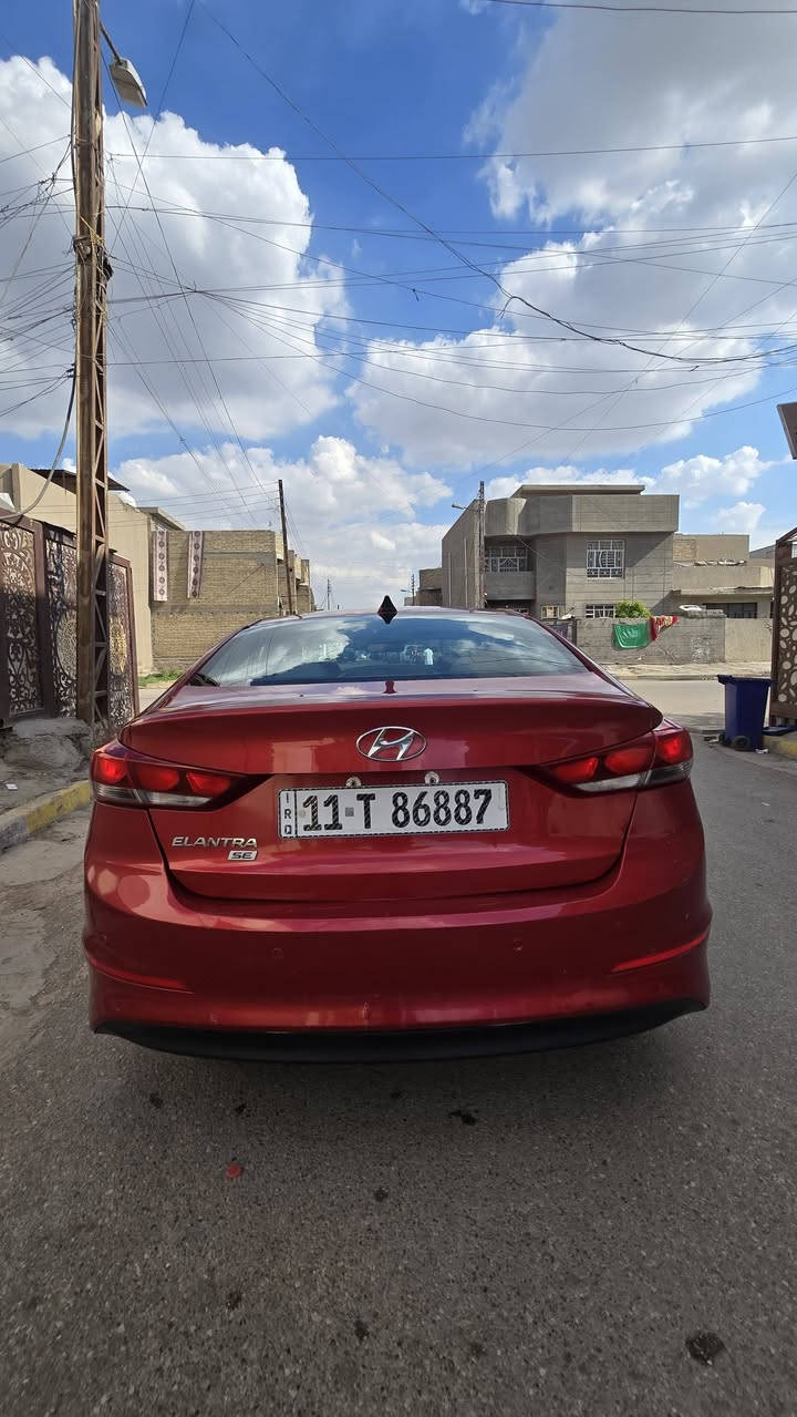 سلام عليكم النترا موديل 2017 وارد امريكي السياره الجديده ونظيفه تخم تاير جديد صدر خلفي وامامي جديدات نص فول السياره جديده بمعنى الكلمه ليبل واحد السياره كله مكينه 2000دوش + الكير نظيفات مكفولات (ملاحضه السونار مرفق معه المنشور)مكان السياره المدينه مقابيل شقق الحبيبيه السعر 114
للاستفسار *********** تحويل مباشر
