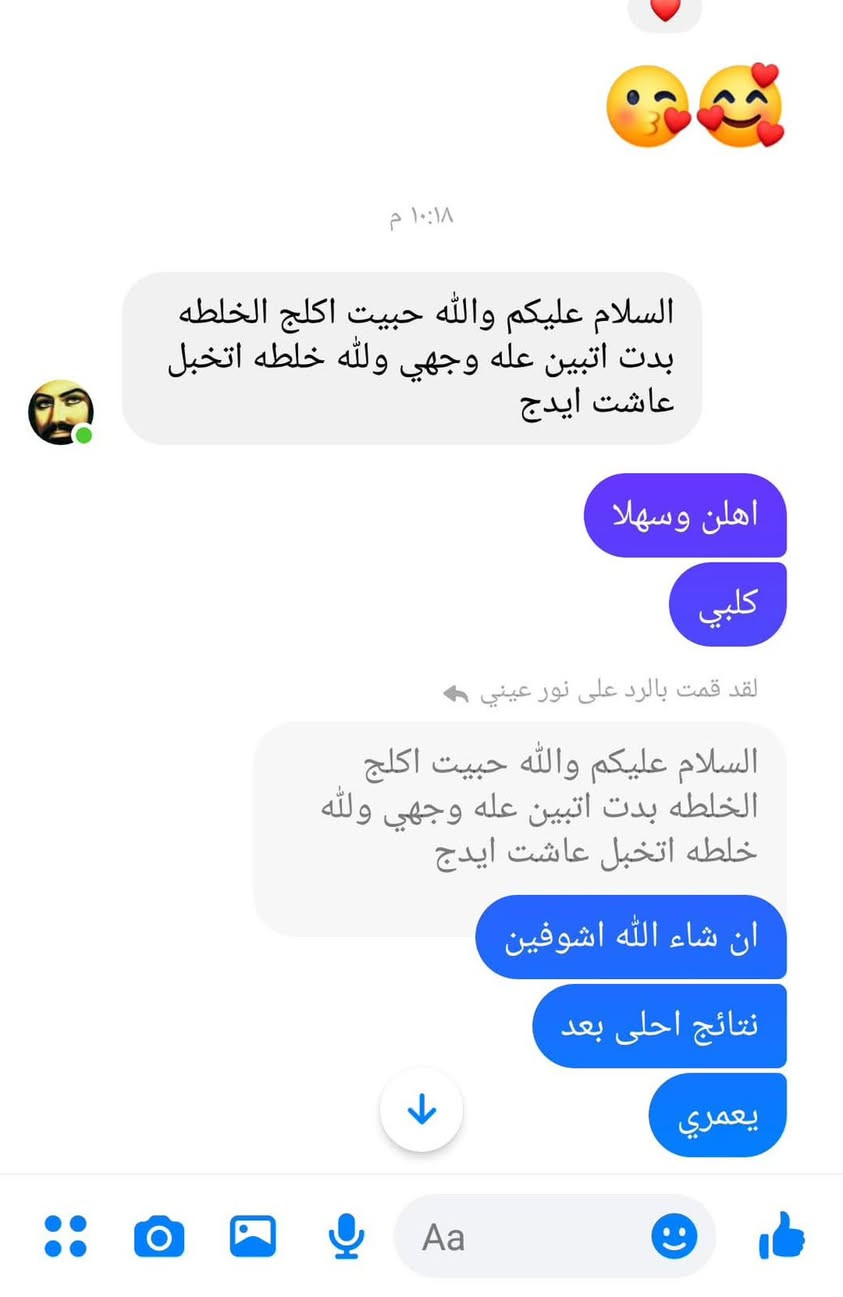 عرض ع الخلطه امانة الله ممتازه هاي تجارب البنات دخلو وشوفو ع الصور إمامة الله
تقضي على الحبوب واثاره والتصبغات والكلف تنطي نظاره كل خلطه  مع هديه ماسك الوجه وصابونه والتوصيل مجاني داخل النجف فقط  والتوصيل مجاني العرض لمدة محدوده


**إذا كنت صاحب هذا الإعلان وتريد حذفه لأي سبب، رجاءا أرسل رسالة إلى الدعم الفني**