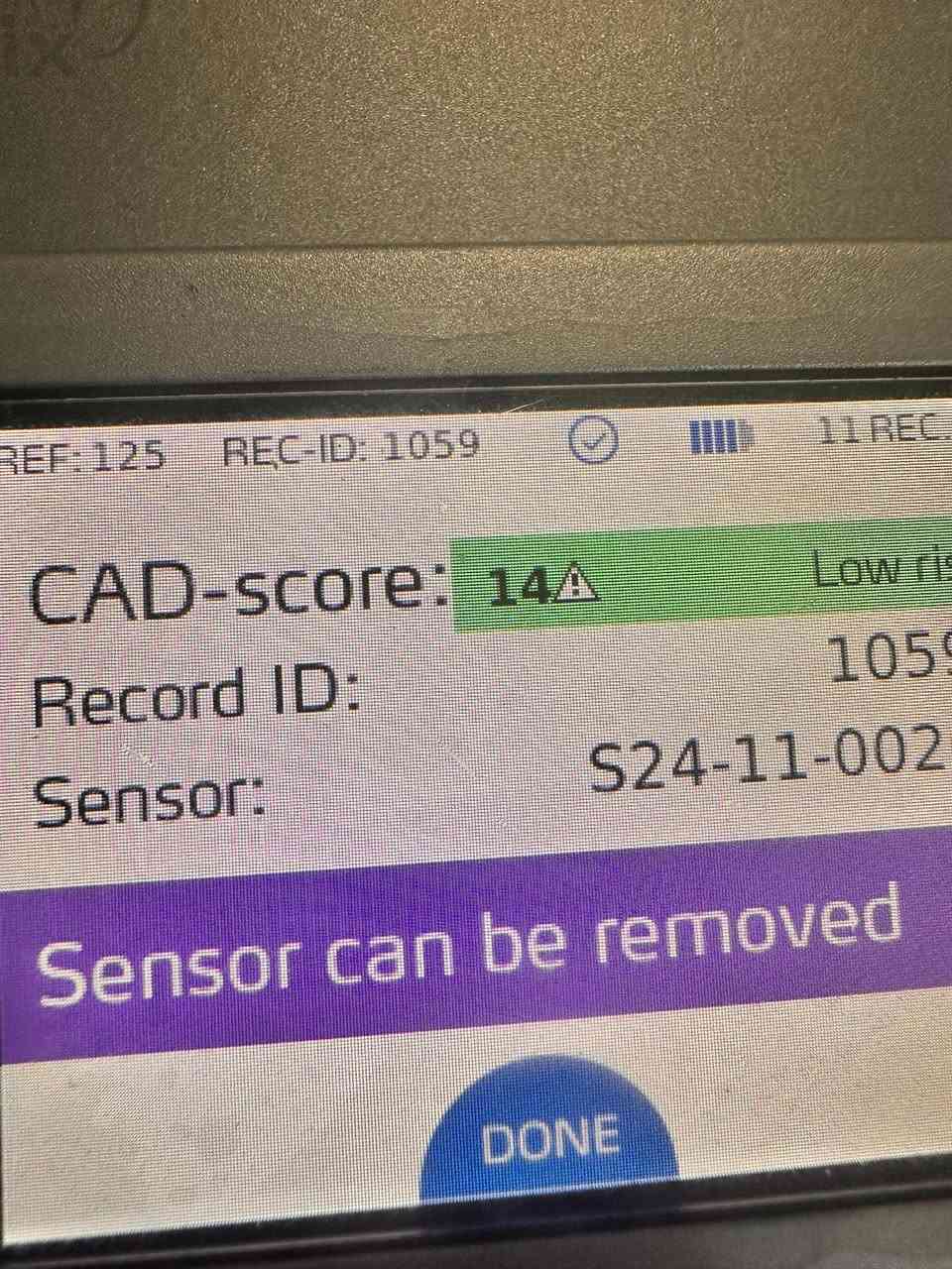 فحص الشرايين بالجهاز المتطور يسأل الناس كثيرا عن طبيعه العمل وعن سعر الفحص .
حسب قوانين الجاريه في بلدنا لا يجوز نشر اي اسعار في السوشيل ميديا وكل المعلومات المطلوبه التي ترغب معرفتها ممكن ان تعرفها بالاتصال على السكرتيره وهذه نبذه عنه 
جهاز فحص الشرايين التاجيه بالأمواج فوق الصوتيه لا يحتوي على اشعه ضاره او اي صبغه ووقت الفحص اقل من ربع ساعه من خلال وضع الجهاز على مكان القلب فوق القفص الصدري لتسجيل إذا كان هناك ضيق في الشرايين او لا.الفحص يكون إذا كان هناك علامات من القلب مثل الم او ضيق نفس او حتى يستعمل تجييك قلبك إذا لا توجد اي علامات للاطمأنان. متوفر حاليا في اربيل وفي بغداد. للحجز والاستفسار الاتصال اسيا او وتس اب *********** وشكرا 
#وليدسرحان
