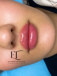 دكتورة إيثار • تجميل غير جراحي • الكوت الشهداء