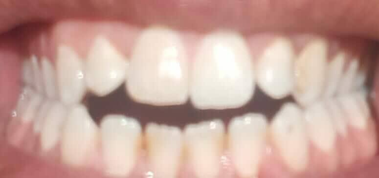 هذا معجون اسنان مارفس الايطالي وين متلكون الاصلي اخذو منه يجنن وعن تجربه واستخدامه مره بالاسبوع فقط مو اكثر
وملاحضه يمي ايضا متوفر وشرط الاصلي


**إذا كنت صاحب هذا الإعلان وتريد حذفه لأي سبب، رجاءا أرسل رسالة إلى الدعم الفني**