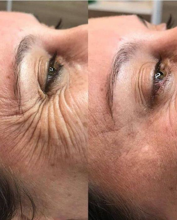 عروض العيد الفطر 
تغير شامل 250الف                                             فلر شفه سعر السيسي 50الف رقم الهاتف ‏‪***********‬‏
