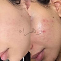 سيرومات بشرة • للرجال والنساء • الرمادي الأنبار
