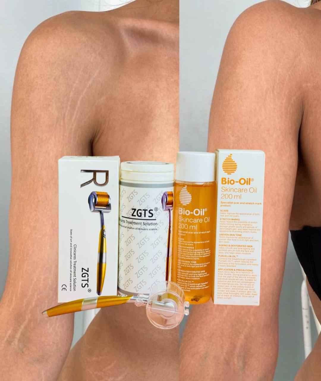 ✨ عرض علاج التشققات وتجديد البشرة للوجه والجسم ✨

احصلي على بشرة أنعم وأجمل مع مجموعة العناية المتكاملة ❤️

🧖‍♀️ أولاً: ديرمارول الأصلية 💯
تساعد على تجديد خلايا البشرة وتحفيز الكولاجين، وفوائدها:
✅ تقليل التشققات وعلامات التمدد
✅ تحسين مرونة وملمس الجلد
✅ تصغير المسام
✅ تخفيف آثار حب الشباب والندوب
✅ تقليل الخطوط والتجاعيد

🌿 ثانياً: زيت بايو أويل الأصلي 💯💯
زيت فعال لتحسين مظهر البشرة:
✅ تقليل التشققات والخطوط البيضاء
✅ توحيد لون البشرة والتصبغات
✅ تحسين آثار الندوب والحروق
✅ ترطيب البشرة الجافة ومنحها نعومة Honolulu, HI


**إذا كنت صاحب هذا الإعلان وتريد حذفه لأي سبب، رجاءا أرسل رسالة إلى الدعم الفني**