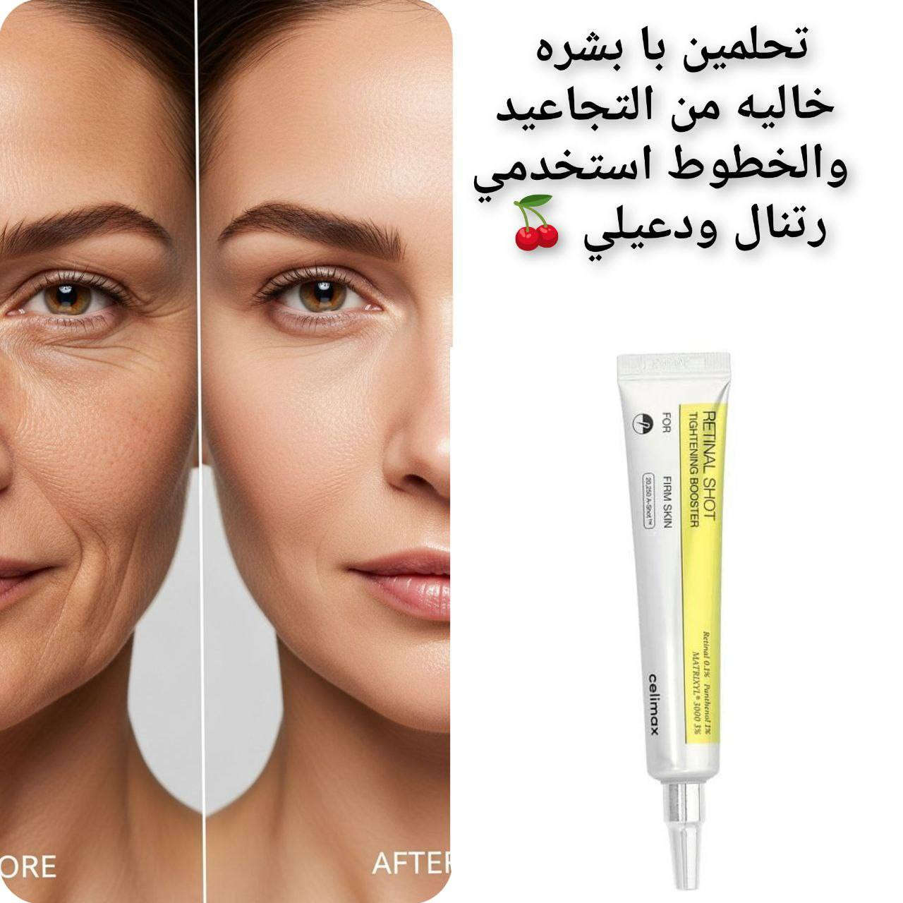 ⭕ الترند العالمي رجع توفرر ..😱♥️

 ريتينول شوت الاصلي الكوري معزز لشد البشرة المعالج للتجاعيد 💯
مصمم لمعالجة التجاعيد، تفاوت ملمس البشرة، والمسام الواسعة.
للحجز #خاص #ابنت_اكتوبر


**إذا كنت صاحب هذا الإعلان وتريد حذفه لأي سبب، رجاءا أرسل رسالة إلى الدعم الفني**