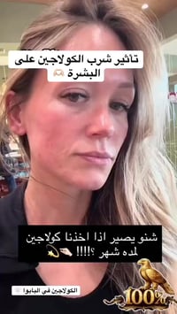 شراب كولاجين • نضارة • شد البشرة