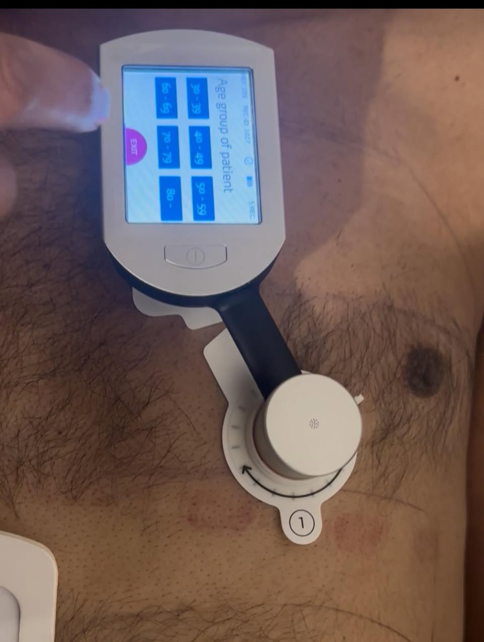 فحص الشرايين بالجهاز المتطور يسأل الناس كثيرا عن طبيعه العمل وعن سعر الفحص .
حسب قوانين الجاريه في بلدنا لا يجوز نشر اي اسعار في السوشيل ميديا وكل المعلومات المطلوبه التي ترغب معرفتها ممكن ان تعرفها بالاتصال على السكرتيره وهذه نبذه عنه 
جهاز فحص الشرايين التاجيه بالأمواج فوق الصوتيه لا يحتوي على اشعه ضاره او اي صبغه ووقت الفحص اقل من ربع ساعه من خلال وضع الجهاز على مكان القلب فوق القفص الصدري لتسجيل إذا كان هناك ضيق في الشرايين او لا.الفحص يكون إذا كان هناك علامات من القلب مثل الم او ضيق نفس او حتى يستعمل تجييك قلبك إذا لا توجد اي علامات للاطمأنان. متوفر حاليا في اربيل وفي بغداد. للحجز والاستفسار الاتصال اسيا او وتس اب *********** وشكرا 
#وليدسرحان
