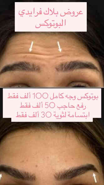 عيادات الرحمة الطبية 
قسم التجميل و الليزر 

مجمع بسمايه السكني -مقابل البوابة الجديدة بناية كوفي حنوش الطابق الأرضي 
للحجز ***********
@إشارة
