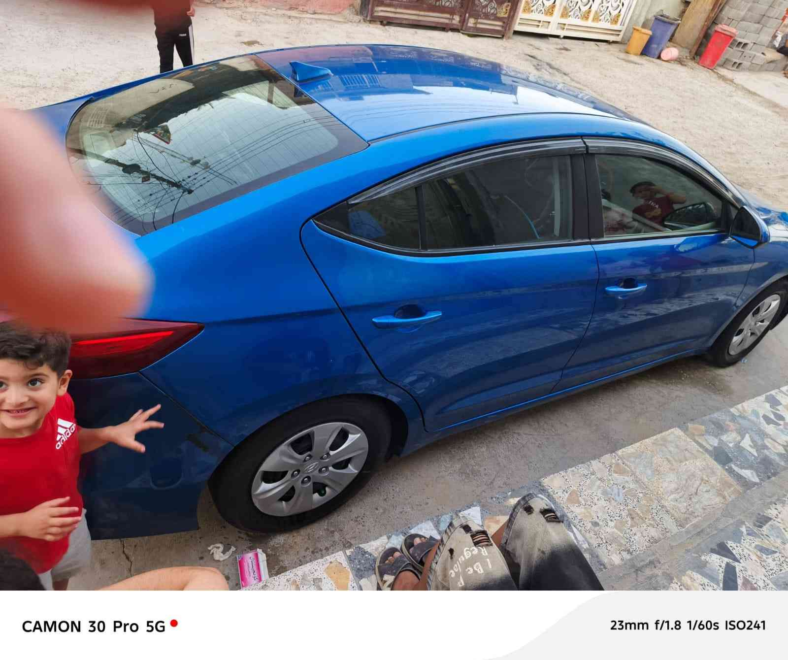 النترا 2017 وارد امريكي سيارة بسمي وكلشي موضح بالصور العنوان الكاظمية رقم ***********
السعر 116 وبيهة مجال
