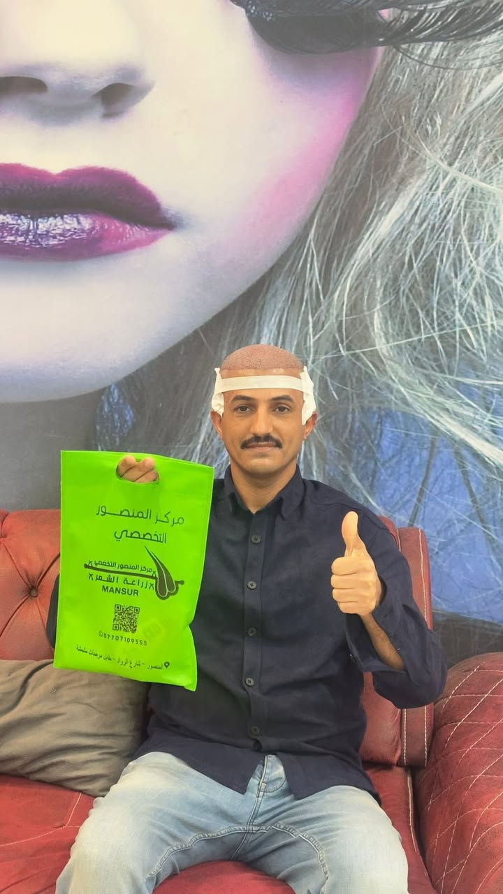 عملية بنفس اليوم ✨

رغم إنو المنطقة المانحة ضعيفة،  
گدرنا نوصل لنتيجة مميزة بـ تغطية كاملة  
من خلال توزيع مدروس واحترافي للبصيلات 🔥

الفرق مو بس بعدد البصيلات…  
الفرق بخبرة الفريق وطريقة الشغل 👌

نتائج طبيعية
وكثافة محسوبة من أول جلسة 💯

اختصاصنه المانحات الضعيفه وبجلسه وحده بس

للحجز والاستفسار 
***********

او زورونا بموقع العياده
بغداد المنصور شارع الرواد مقابل مرطبات مشمشه
