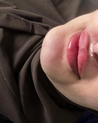 فلر شفه • مراجعة • د. حوراء محمد