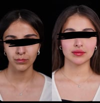 عيادة تجميل • أربيل • مجاناً ل٣ سيدات