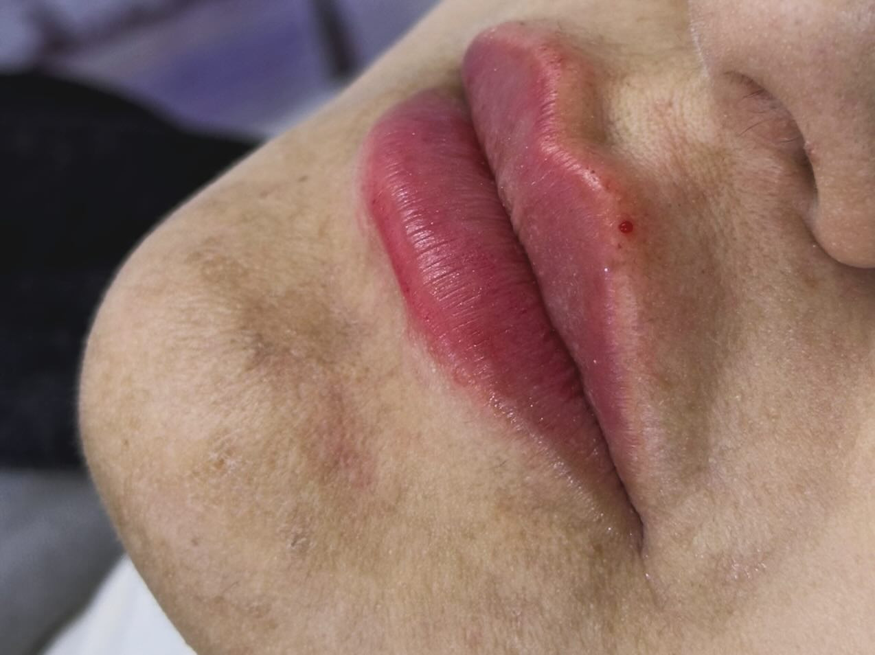 #احلى فيلر 
طبعا والله التصوير كولش يضلم النتائج بالحقيقه تجننن ❤️🔥🔥👌


**إذا كنت صاحب هذا الإعلان وتريد حذفه لأي سبب، رجاءا أرسل رسالة إلى الدعم الفني**