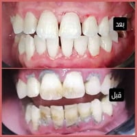 خانقين • عيادة أسنان • تقسيط بدون فوائد