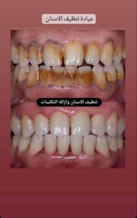 عيادات مجانية • علاج أسنان • استشارات واتساب