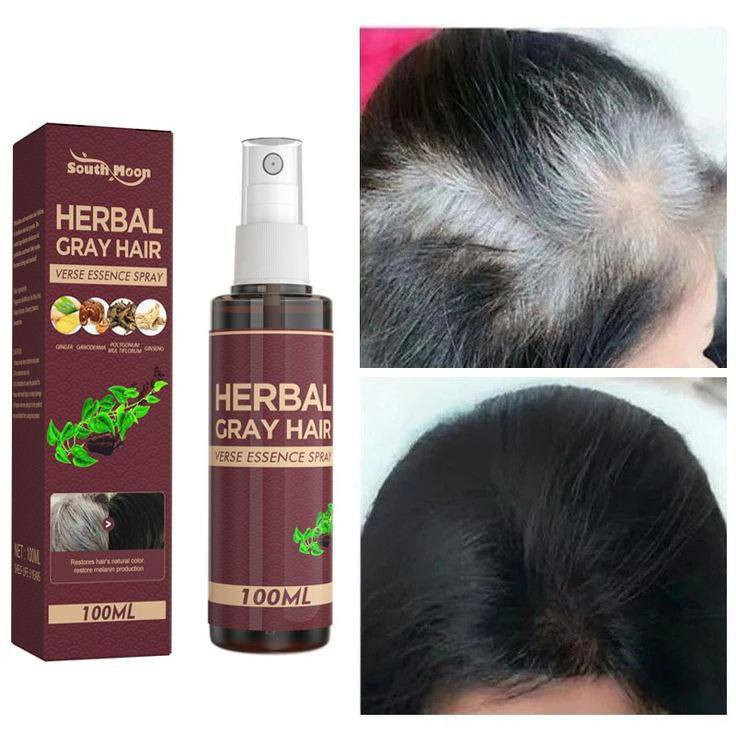 بخاخ HERBAL GRAY HAIR VERSE ESSENCE SPRAY (بخاخ خلاصة الشعر العشبي للشعر الرمادي).
يغذي الشعر وفروة الرأس بعمق.لاستعاده اللون الطبيعي 
يعزز إنتاج الميلانين.. .
مصنوع من مكونات عشبية طبيعية وآمنة.
يساعد في إصلاح بصيلات الشعر التالفة ويترك الشعر ناعمًا ولامعًا

#يوجد_توصيل_لكافه_المحافظات


**إذا كنت صاحب هذا الإعلان وتريد حذفه لأي سبب، رجاءا أرسل رسالة إلى الدعم الفني**
