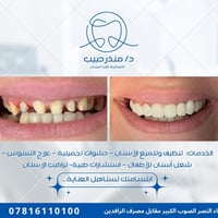 عيادة أسنان • قضاء النصر الصوب الكبير • مواعيد ٨ص-١٢ظ،٢:٣٠-٨:٣٠م