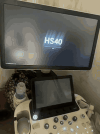 سلام عليكم  
 جهاز للبيع  سامسونك      HS 40
 اصدار 2018      
بروبات 4 
ايكو وسونار وفور دي  وغده وثدي
شغال كل نقص مابي 
ويوجد الطابعه مال فور دي ويا
السعر خاص 
للتواصل:  ***********
