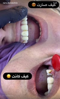 طب اسنان • تجميل اسنان • ٣-٨م