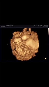 لأن كل تفصيلة تستاهل تُشاهد ✨ سونار رباعي الأبعاد في عيادتنا… دقة، راح...