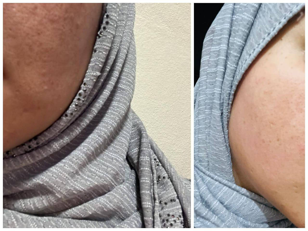 بنات هاي الخلطةدمار تخلي وجهج كزازة يوج وج شاهد الله عليه وبيه ضمان فلوسج ترجعلج بس  والقران تصفي وجهج وتبيضه مابيه خسارة تعاني من كلف عنيد وما لقيتِ حل؟
خلطة فوريفر للوجه تساعد على:
✔ تفتيح التصبغات
✔ توحيد لون البشرة
✔ ترطيب وتغذية عميقة
✔ إشراقة طبيعية بدون إرهاق البشرة

منتجات طبيعية…
نتائج تُلاحظ مع الصبر والاستمرار ✨

الخلطله الملكيه💫


**إذا كنت صاحب هذا الإعلان وتريد حذفه لأي سبب، رجاءا أرسل رسالة إلى الدعم الفني**