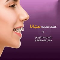 كركوك شارع اطباء • خصم ٥٠٪ • أقساط شهرية