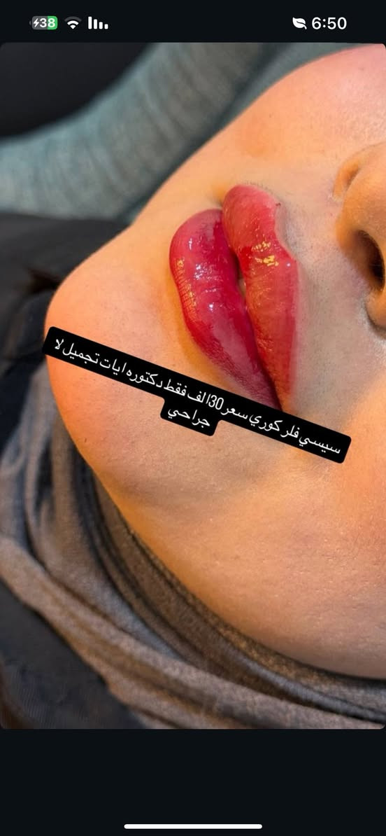 دكتوره ايات. سنتر رزان العنوان  جسر ديالى شارع 60 قرب معهد الزهراء النموذجي او جامع رسول سنتر رزان التجميل رقم الواتساب ***********
