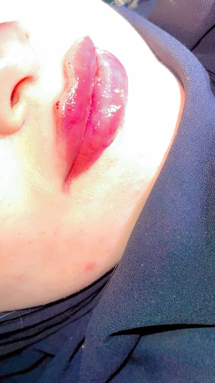 جمال الرسمات بيد دكتورة بدور غيرررر 
واحد ديالى جلولاء  وبخدمة اكثر من ١٢ سنة 
للحجز 
***********
***********
***********
