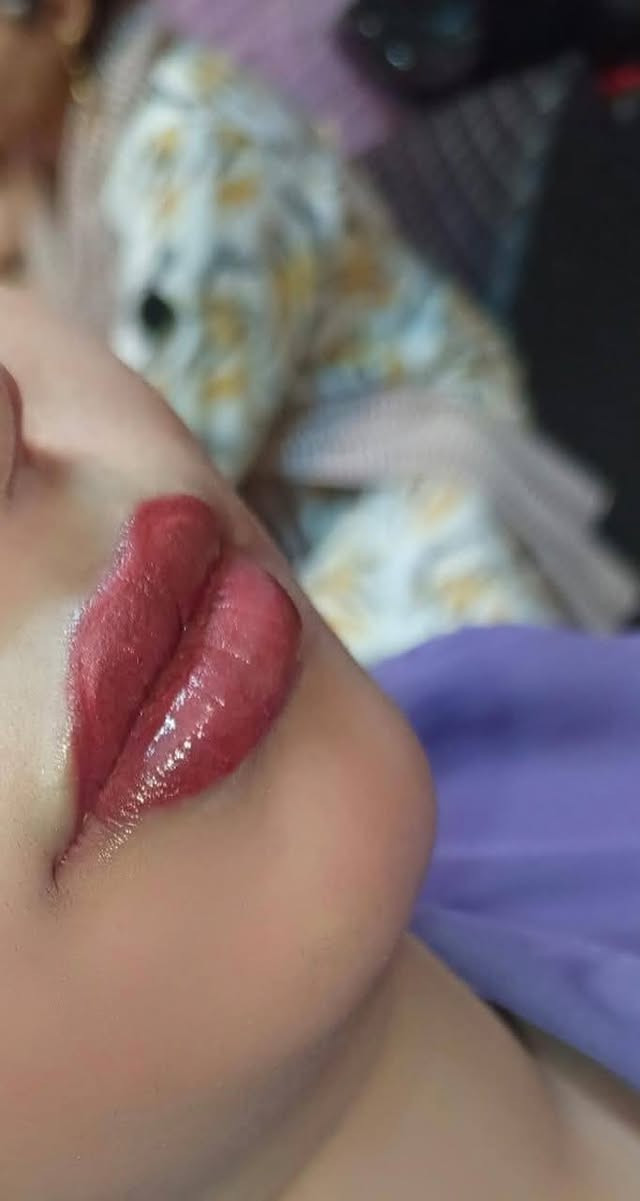 نتائج  توريد الشفه بأحبارنه 💕
تتوفر احبار التوريد    
وبسعر 15الف
توصيل بغداد ٥ محافظات 6
للحجز والأستفسار يرجى مراسلتي خاص  وتدللون ***********
