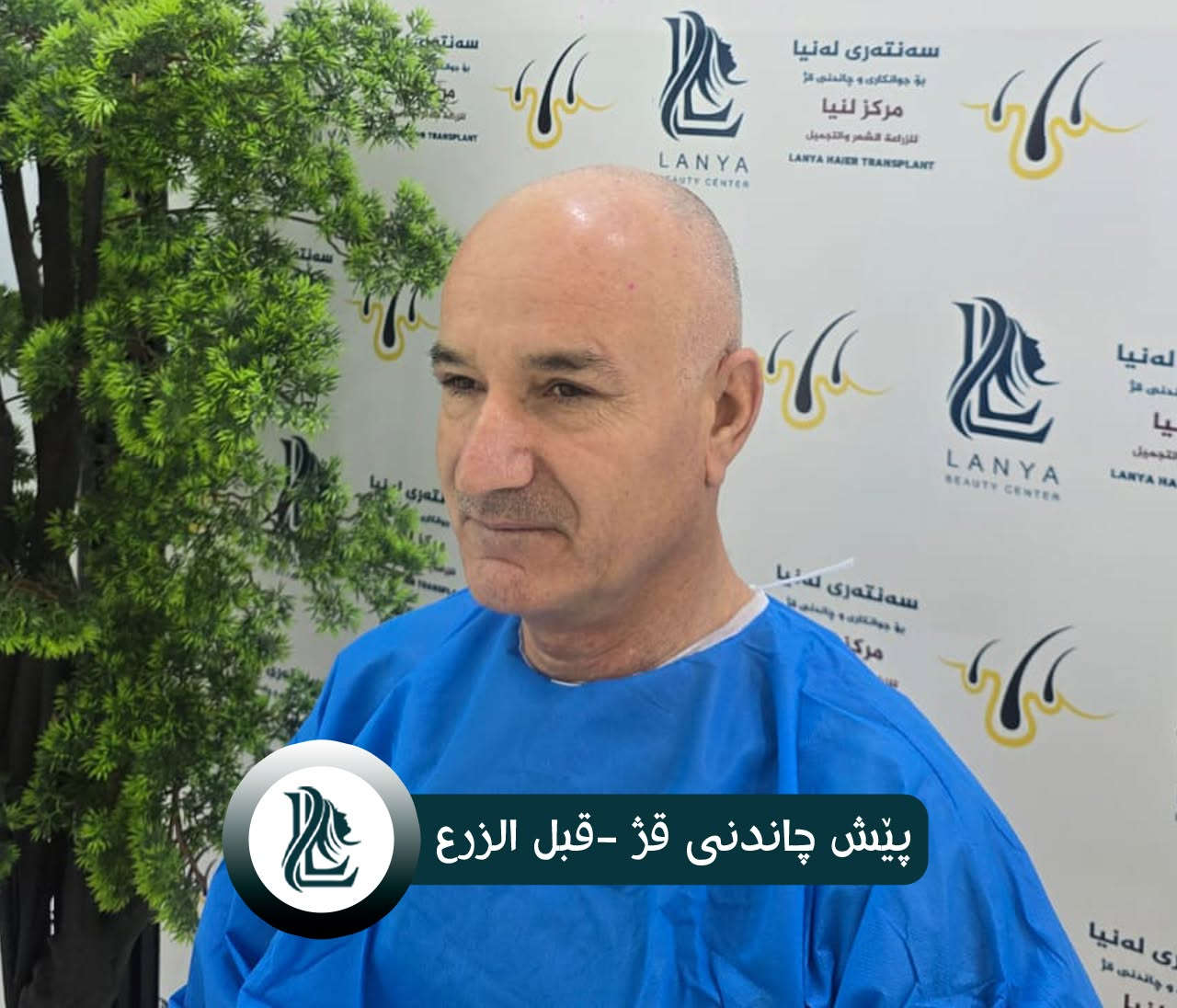 "لأن شعرك سر جاذبيتك، أعد له الحياة مع خبراء لـنـيـا."
🔹 نتائج زراعة الشعر ممیز والفريدة من نوعها تظهر دائمًا في مركز لەنیا .
♦  مع لەنیا حافظ على شبابك.
📍 العنوان:كلار - شارع ليوا - قرب جامع بخاري
📞 رقم التواصل:
***********
🔸🔸🔸🔸🔸🔸🔸🔸🔸🔸🔸🔸🔸🔸
🌿قژی چڕتر، ڕووخسارێکی جوانتر 🌿
چاندنی قژ لە لەنیا، هەنگاوێک بۆ دڵنیایی و جوانی زیاتر.
🔹 ئەنجامی چاندنەوەی قژی بێ وێنە و ناوازە هەموو کات لە سەنتەری لەنیا دەبینرێت 
♦ لەگەڵ لەنیا هەمیشە بەگەنجی دەمێنێتەوە 
📍  ناونیشان: کەلار- شەقامى لیواکە - نزیک مزگەوتی بوخاری
📞  ژمارەی پەیوەندی: ***********
